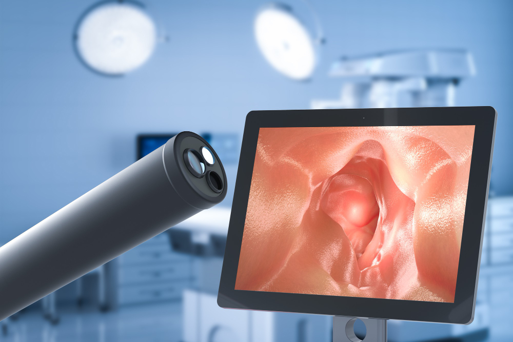 Colonoscopy